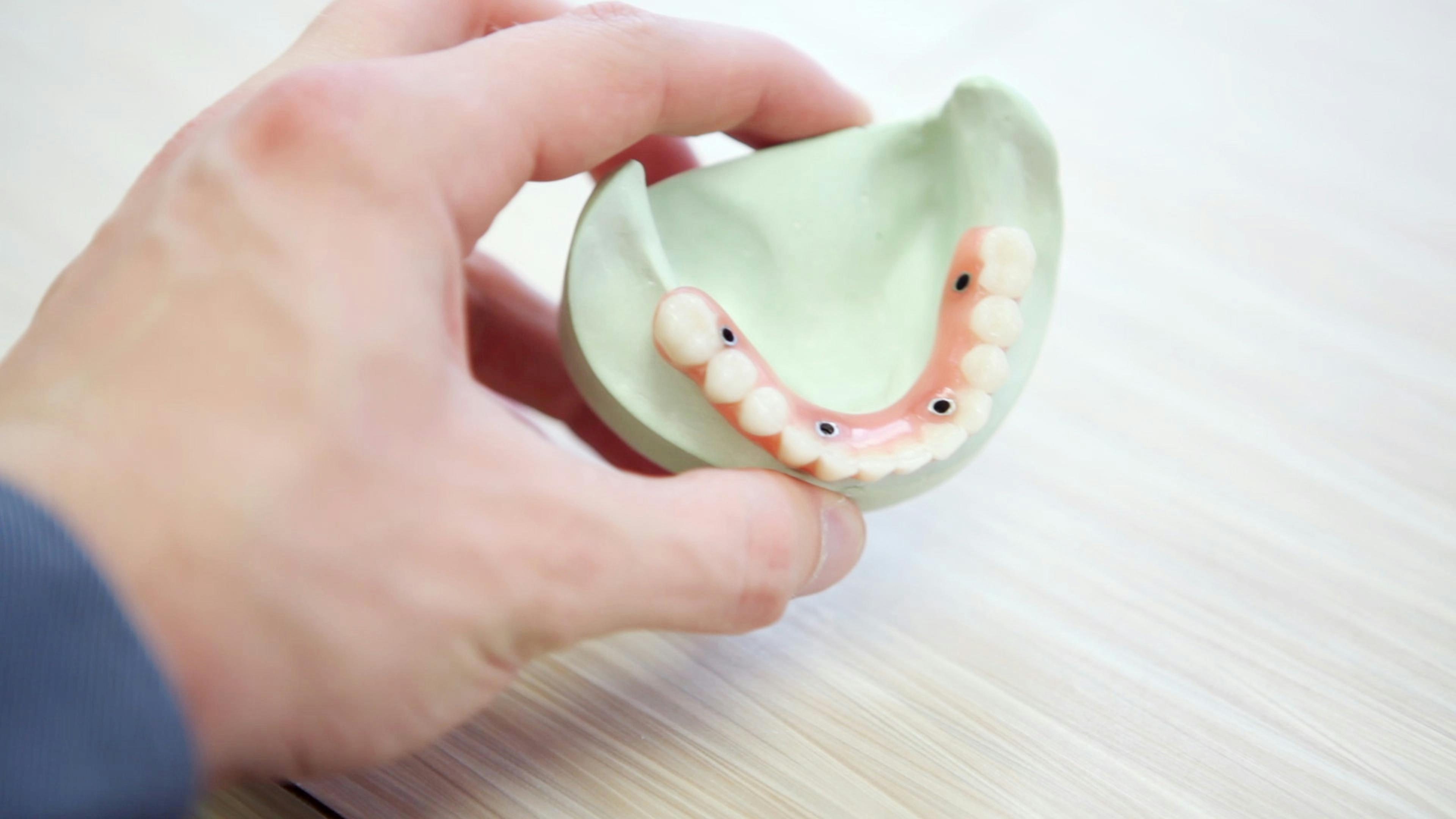 Implant Supported Dentures